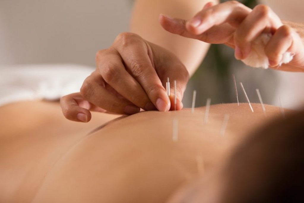 Comissão debate criação do Dia da Acupuntura e da Medicina Tradicional Chinesa